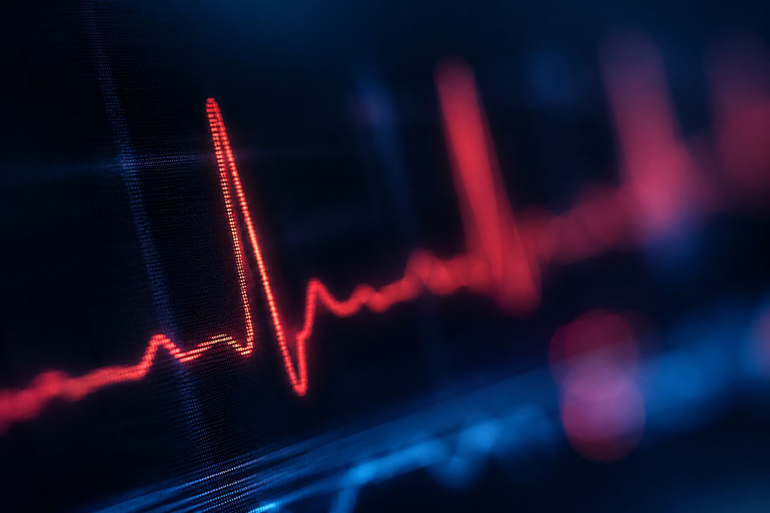 مانیٹر پر دل کی دھڑکن کی لکیر